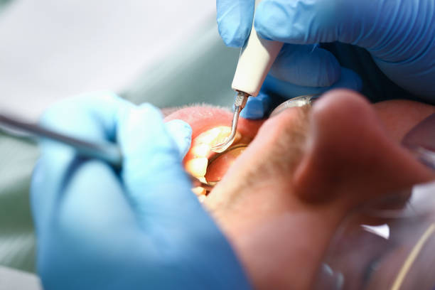 Emergency Gum Pain Relief in OH